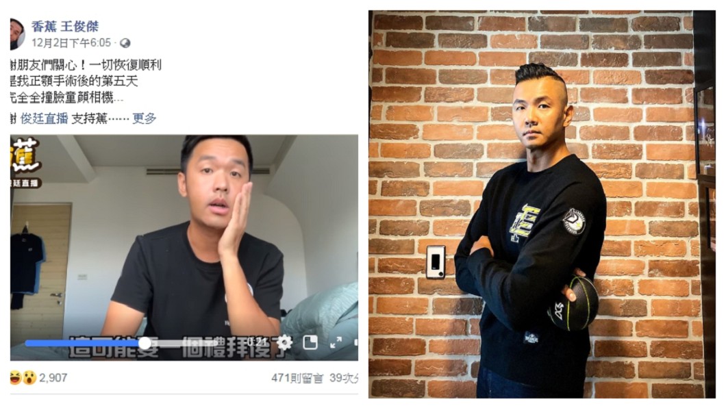 香蕉牙齒「崩壞剩2顆可咬」 動手術竟撞臉黑人