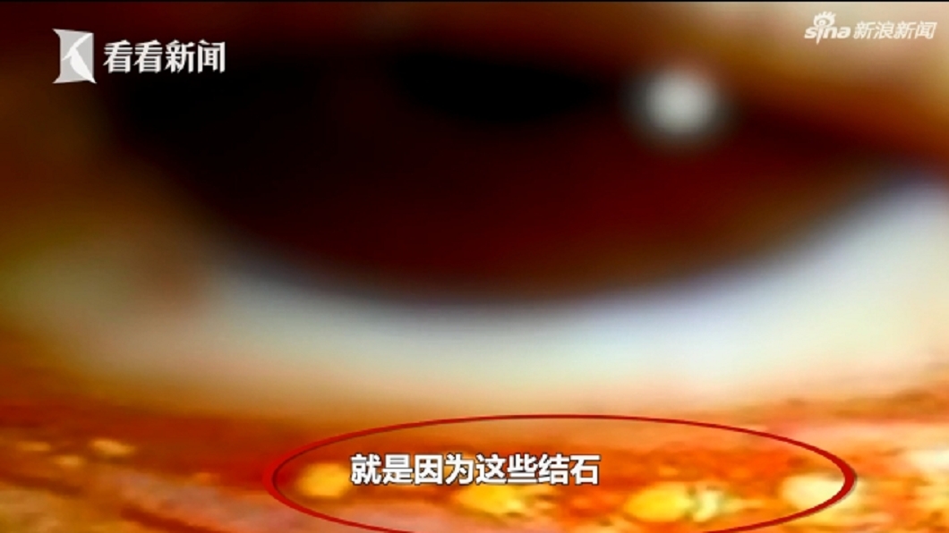 圖/翻攝自看看新聞