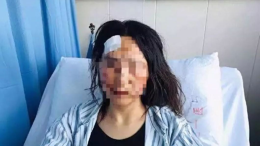 女搭同事順風車…夫揪公公聯手狂毆 拿排泄物塞她嘴