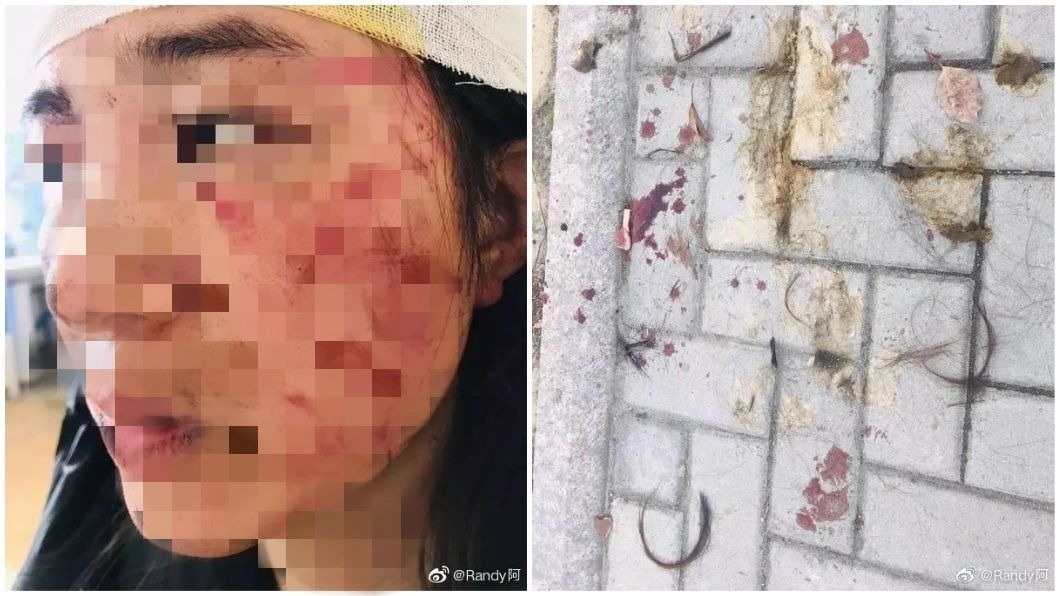 女子臉上有多處傷痕,當下還被對方強把排泄物塞進嘴裡和抹在臉上。(圖/翻攝自微博)