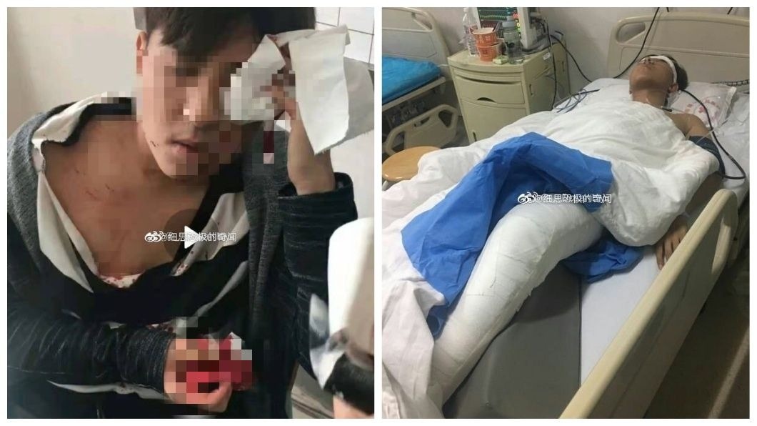 3人爭獎學金喬不攏 碩士男遭2女撂人報復「斷腳筋」