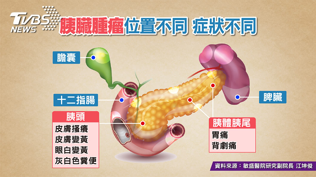 圖/TVBS提供