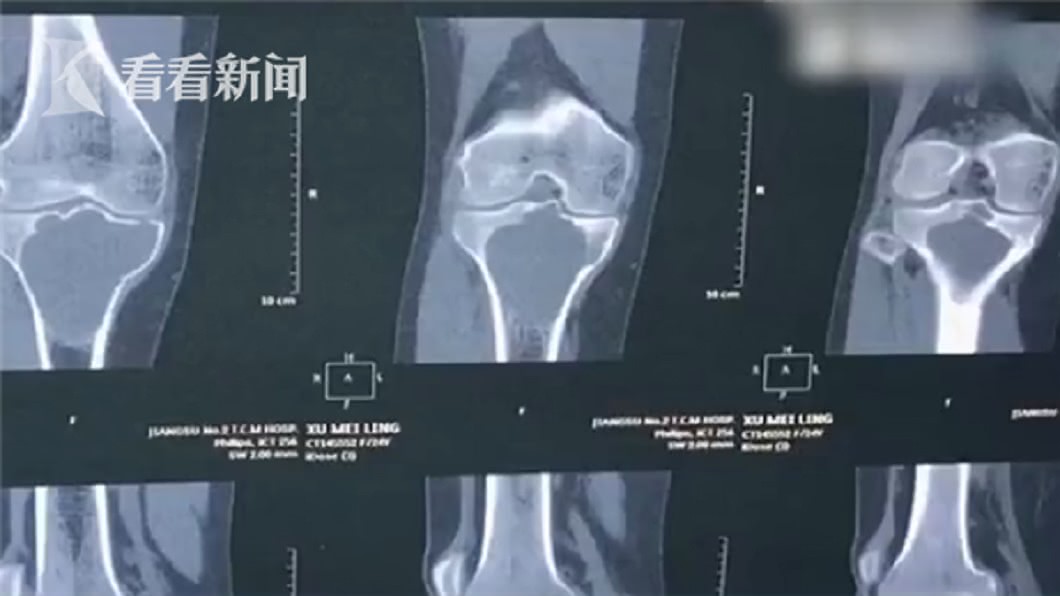 圖／翻攝自看看新聞