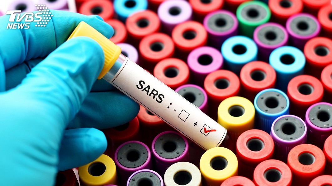 網傳中國7人染SARS　疾管署查證訊息真偽