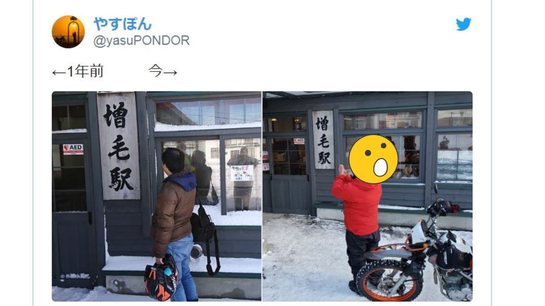 搶救禿頭！他訪「增毛站」許願　曬1年變化照驚呆