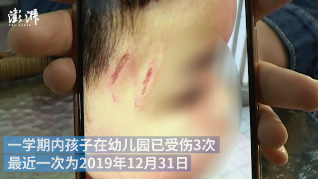 兒屢遭同學施暴　父氣炸要他打回去：別怕爸爸在這