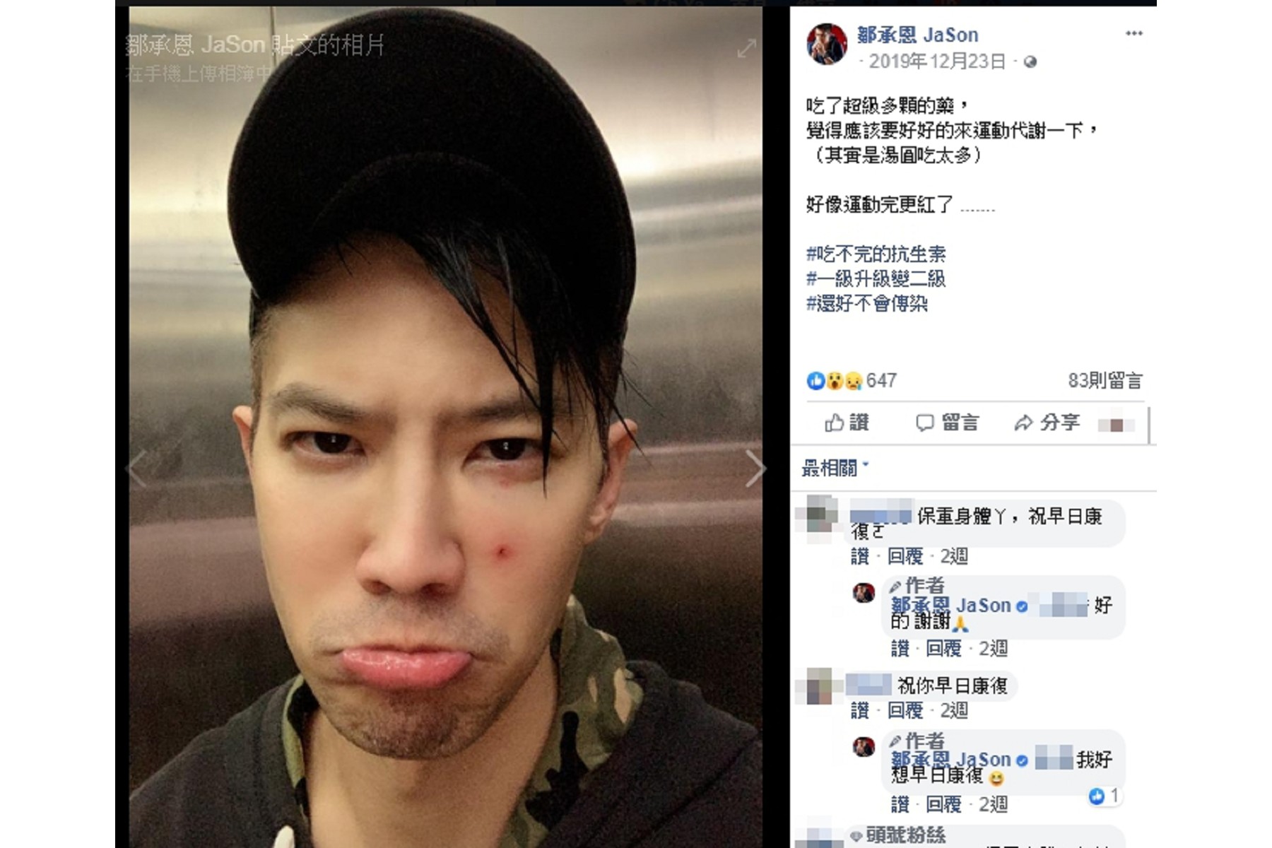 男星鄒承恩近兩個月鮮少出現在螢光幕，原來疑似罹非典型帶狀皰疹。(圖／翻攝自鄒承恩臉書)