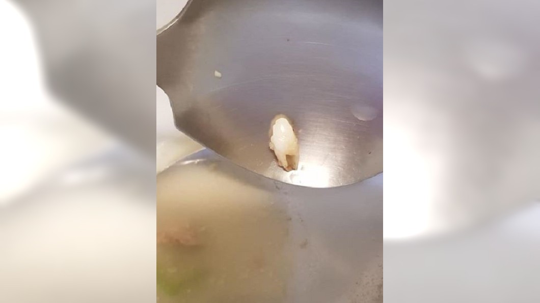 她喝湯「吃到牙齒」激烈嘔吐 網淡定解惑:很正常
