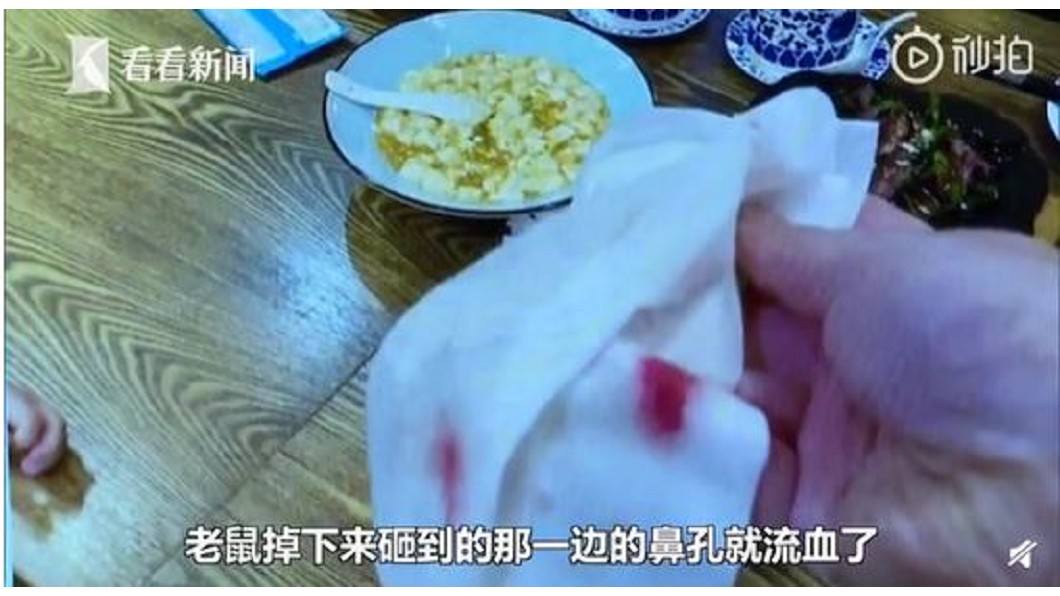 大陸黃姓女子指控在烤鴨坊用餐時，突有老鼠從天花板掉落，鼻子遭砸到流血。(圖／翻攝自看看新聞)