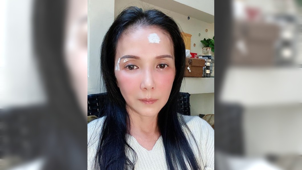 丁國琳大掃除不慎受傷。(圖/翻攝自丁國琳Facebook)