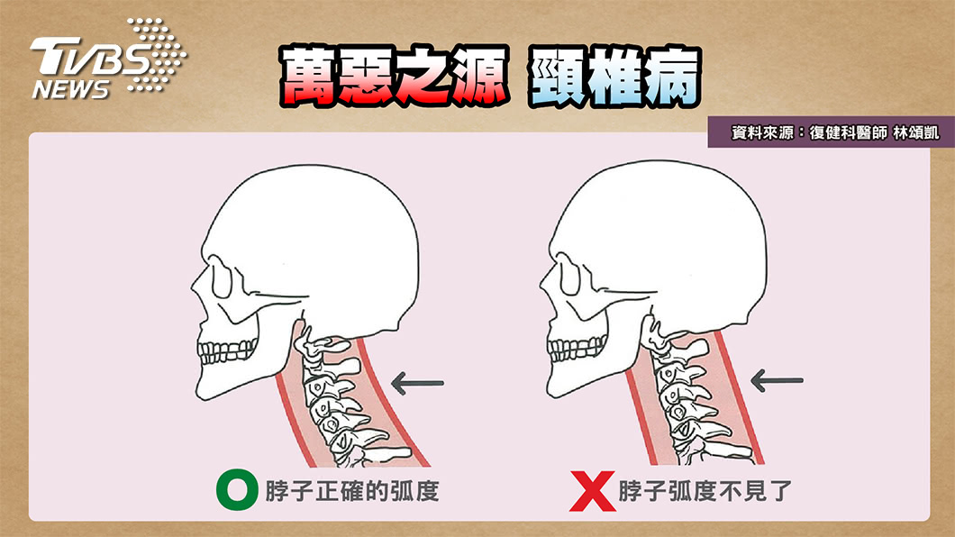 從睡姿看健康!這幾種睡法 小心頸椎正在拉警報