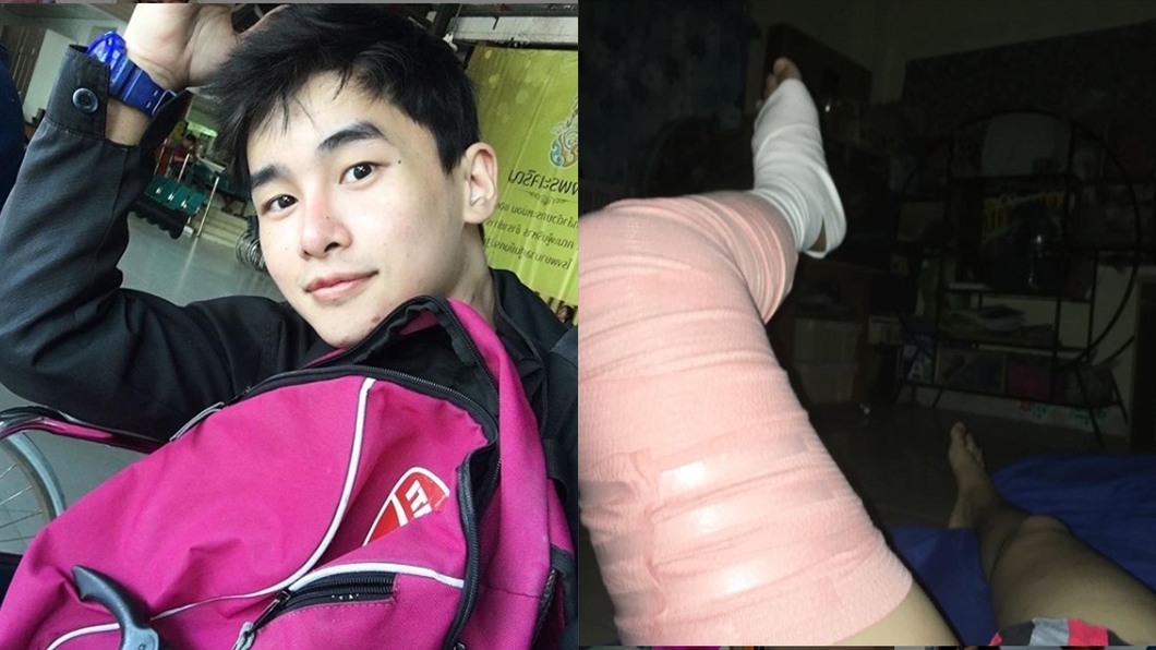 24歲男星癌逝 生前截肢笑PO「我失去腳」成最後訊息
