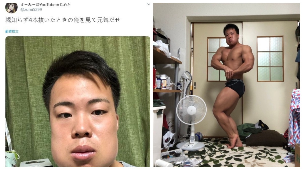 1名健身猛男日前去拔智齒，結果雙頰腫得像豬頭。(圖／翻攝自推特)