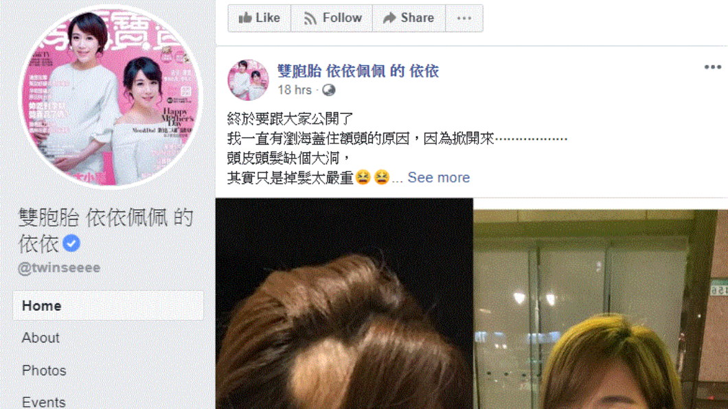 (圖/翻攝自雙胞胎依依佩佩的依依臉書)