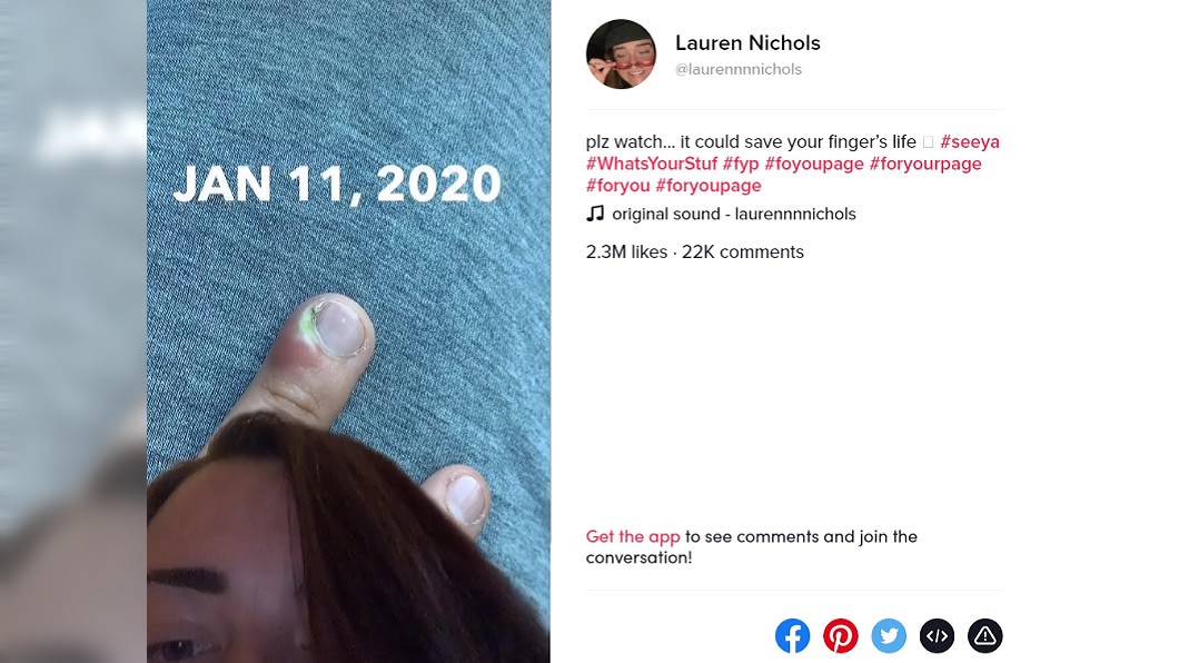 少女蘿倫有咬指甲的壞習慣。(圖/翻攝 Lauren Nichols 抖音)