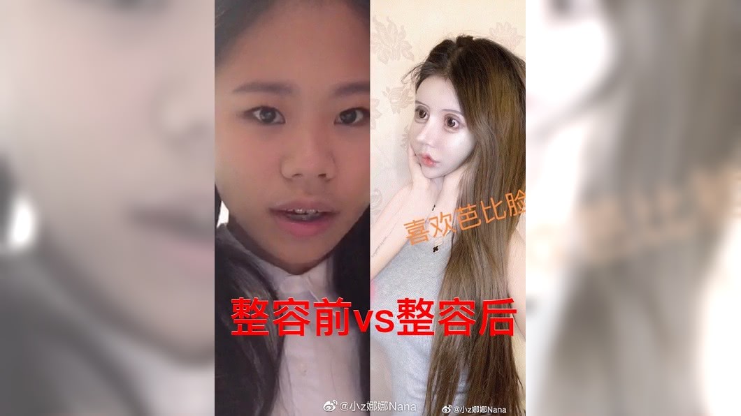 該名女網友自稱16歲,還分享自己整形前後的對比照。(圖/翻攝自微博)
