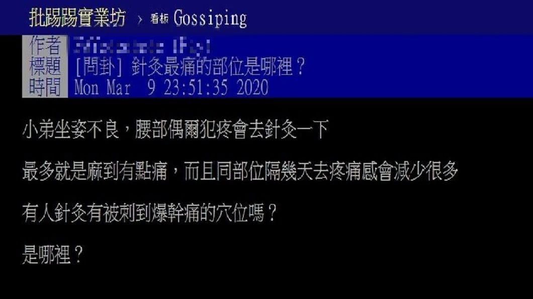 有網友好奇詢問針灸哪個部位最痛?不少過來人分享自己的經驗。(圖/翻攝自PTT)