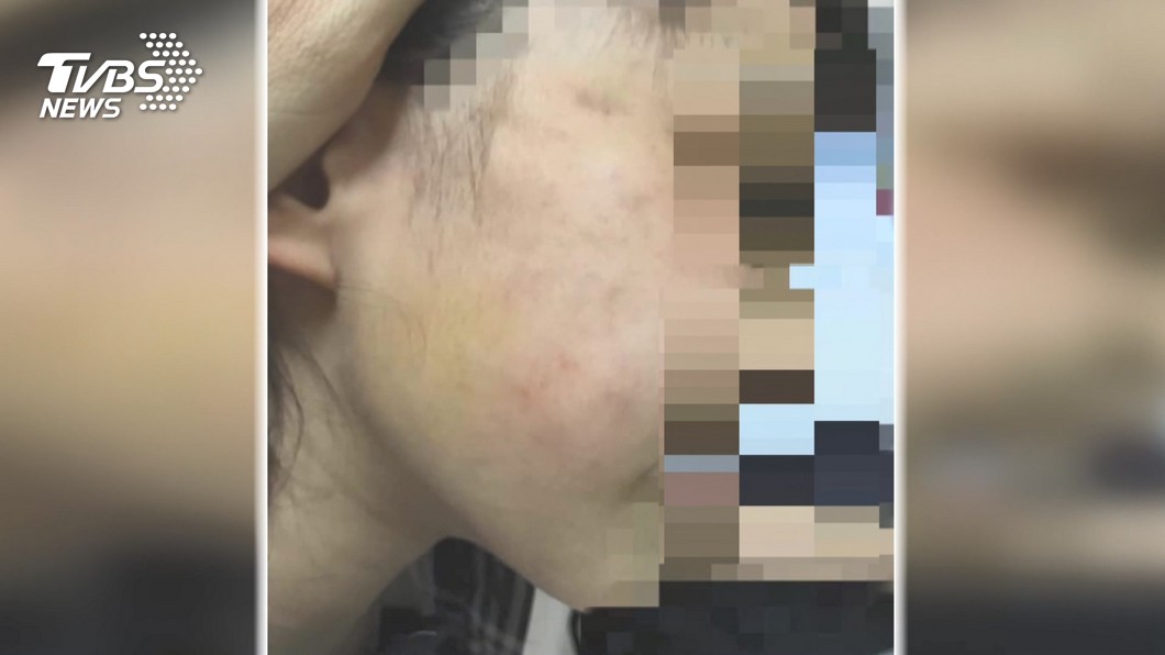 母控女兒遭老師虐打臉 師駁斥:絕無動手
