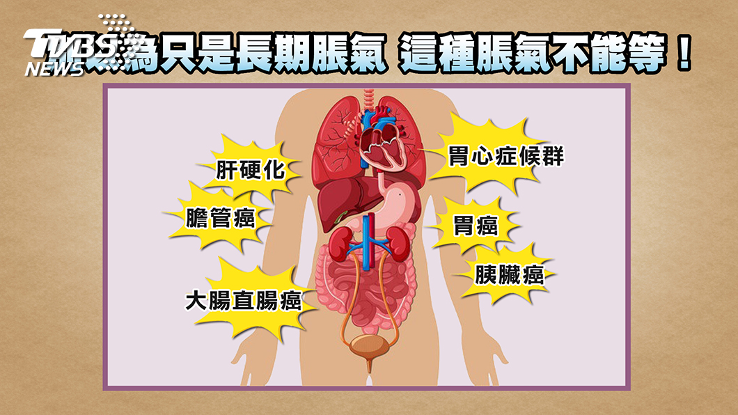 脹氣、腹水分不清 有這症狀別輕忽 小心腫瘤在做怪!