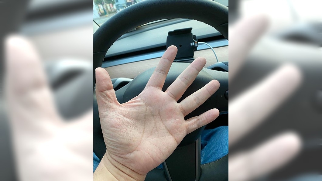 邱豑慶醫師回到車上,看著自己的手,不禁自問「髒嗎?」(圖/邱豑慶醫師授權提供)