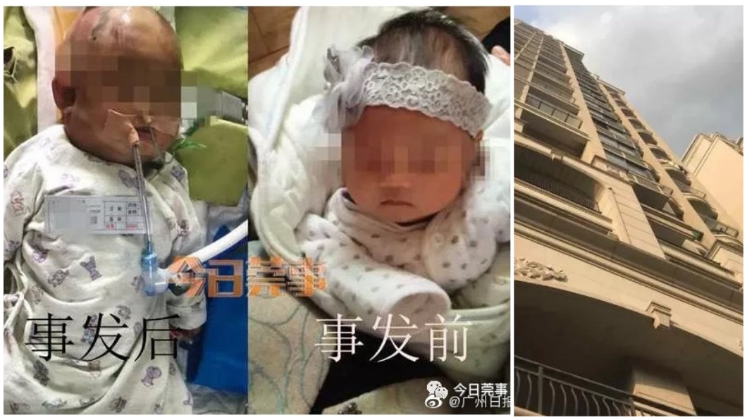 女嬰被砸中頭部,醫師判定她終身傷殘需仰賴照護。(圖/翻攝自廣州日報微博)