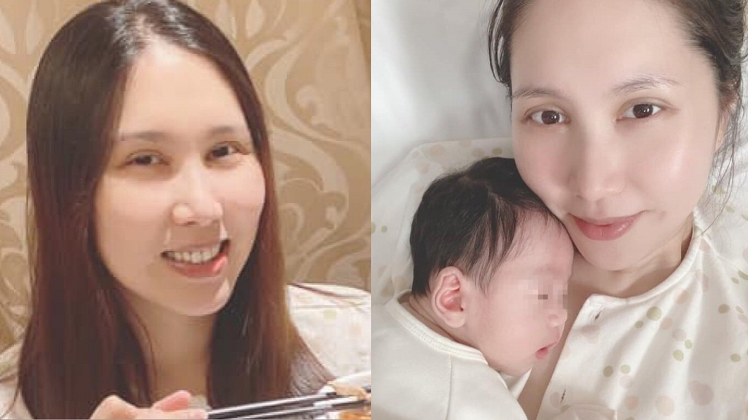 歷經9次化療!余苑綺髮際線稀疏 近況惹眾人心疼
