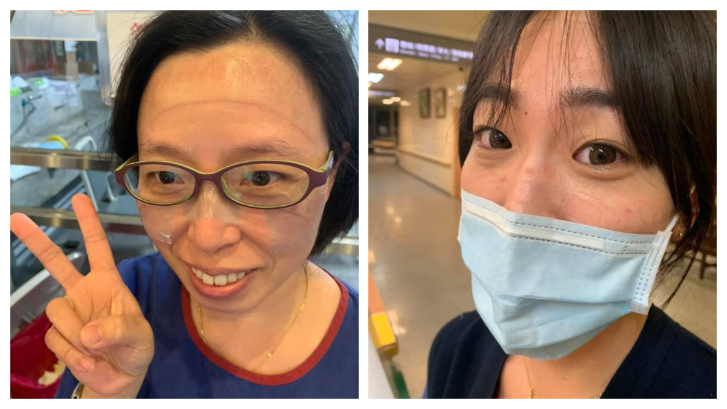 口罩戴到臉破皮 醫護抽空「貼人工皮」:守護生命印記