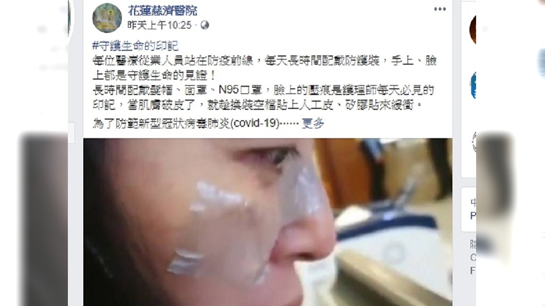 圖/翻攝自臉書 花蓮慈濟醫院