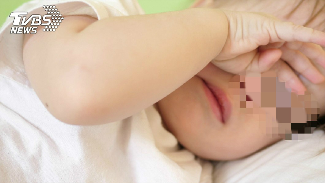2歲女眼睛癢狂揉　「睫毛成20隻陰蝨蟲巢」嚇壞醫