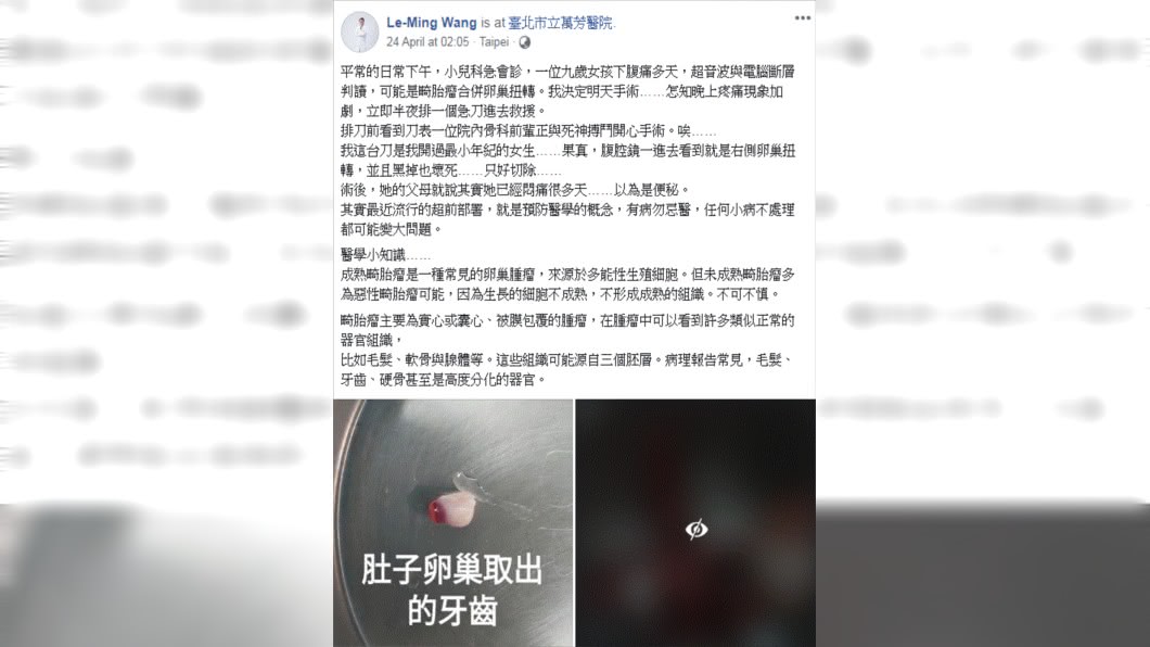 (圖/翻攝自Le-Ming Wang臉書)