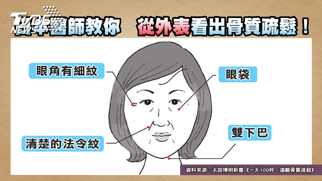 防疫宅在家運動少 當心「骨鬆」年輕化!