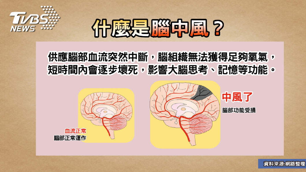 運動撞頭竟語無倫次?!專家教你揪出「大腦未爆彈」