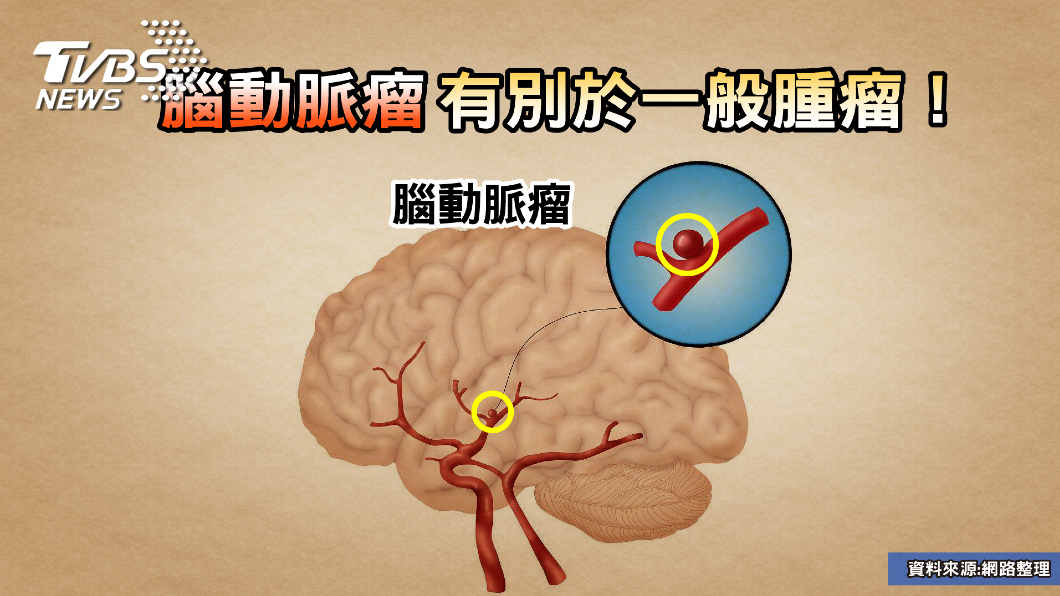 圖/TVBS提供