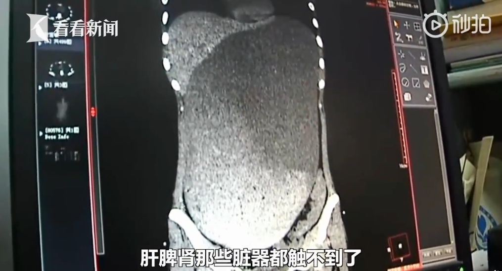 (圖／翻攝自看看新聞)