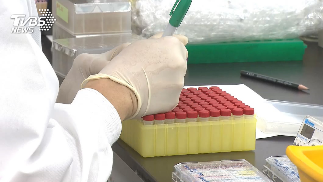 長庚大學抗體檢測技術 可望加速新冠肺炎疫苗研發