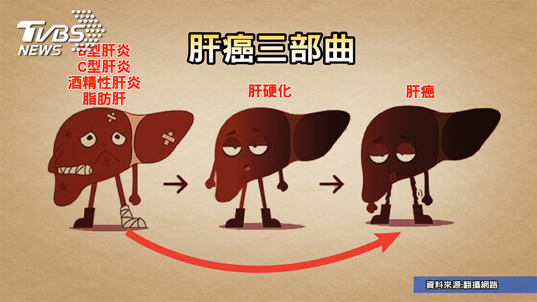 顏清標換肝恐因這習慣 出現這些症狀 小心肝病上身!