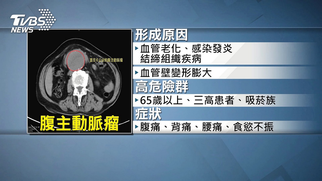 圖／TVBS