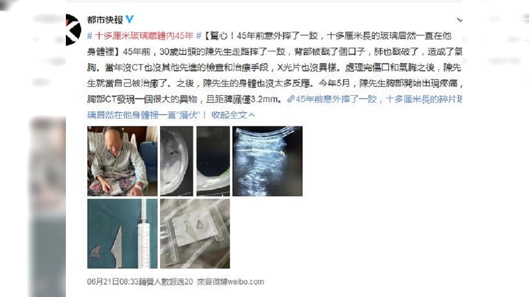 經過追蹤這和45年前的一場跌倒意外所導致。(圖/翻攝自都市快報)