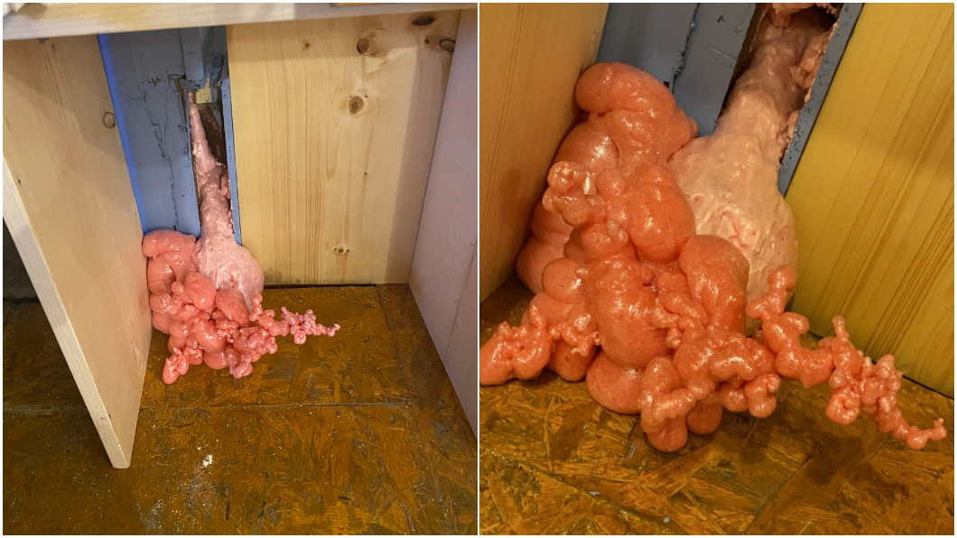 房癌?牆壁破洞「長出」粉紅色肉塊 網:像脂肪瘤
