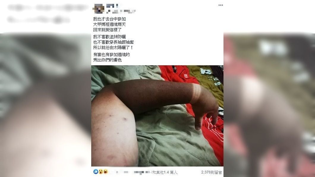 有網友分享自己參與遶境活動2天後手臂的照片,大家看了都嚇呆了。(圖/翻攝自爆廢公社)
