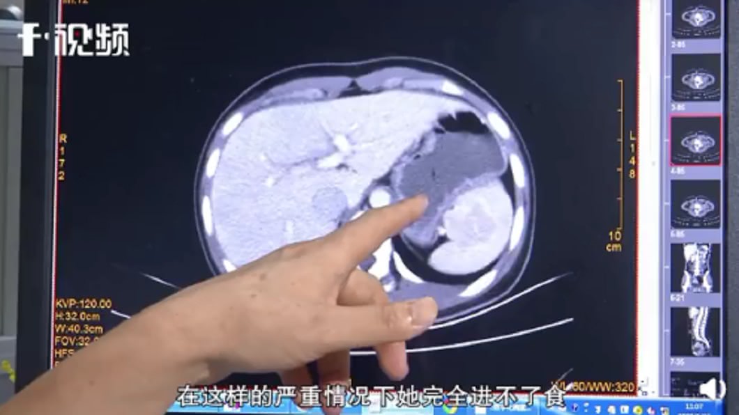 (圖/翻攝自f視頻)