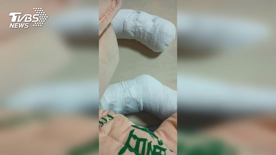 台南4歲女童遭虐雙腳燙傷潰爛 法院裁定繼父收押