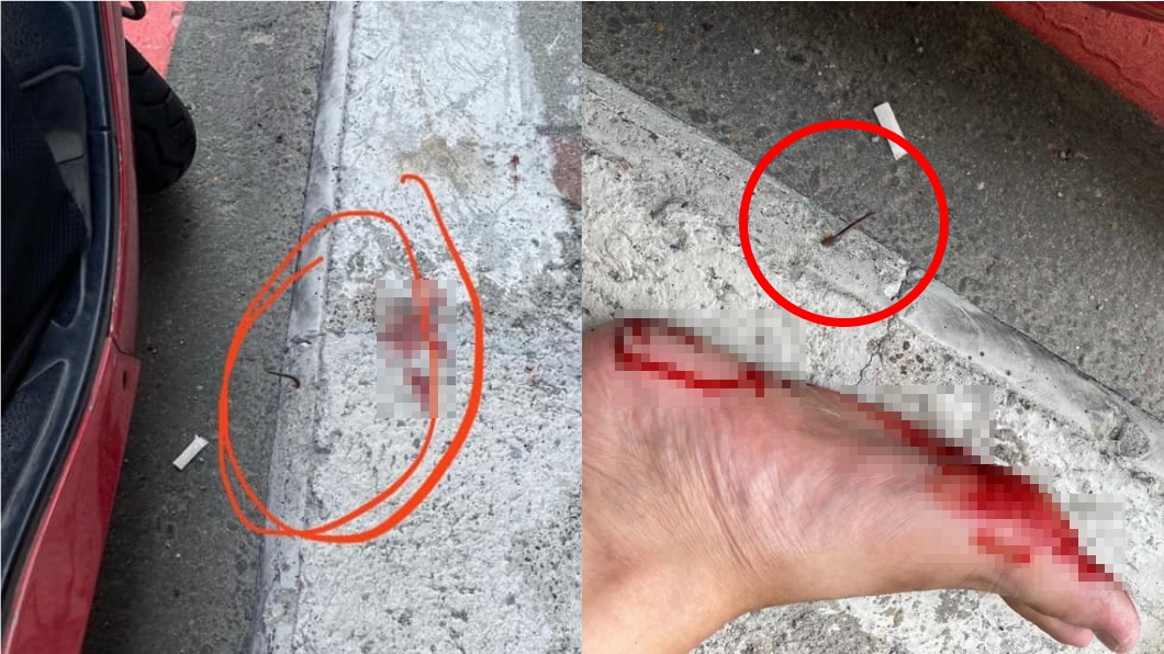 駭人！鬧區人行道藏鐵釘　他散步遭「刺穿腳底」爆血不止