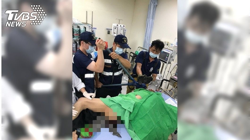 板模工失足從2樓墜下 鋼筋刺穿胸口和骨盆
