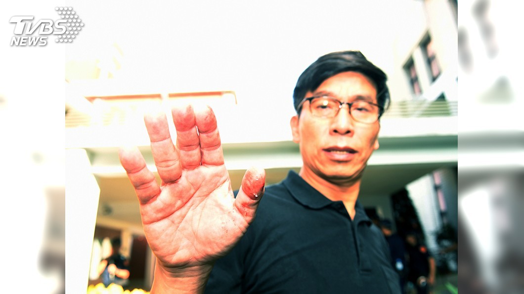 民進黨立法院黨團書記長鍾佳濱上午在衝突中手部掛彩。(圖/中央社)