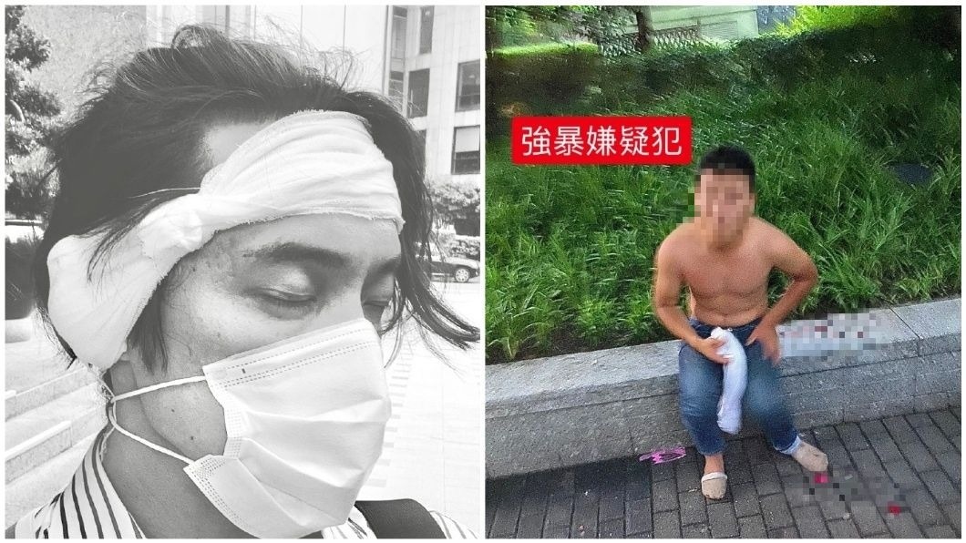 男子事後貼出自己受傷照和嫌犯照片。（圖／翻攝自微博）