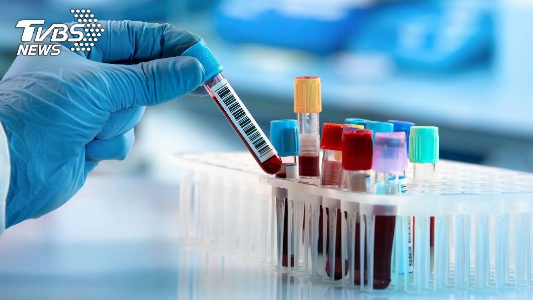 科學家研發血液篩檢法 比常規檢查早數年發現癌症