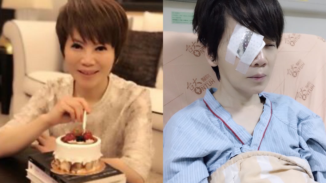 驚爆完全失明!主播急動刀嘆「所有事戛然而止」