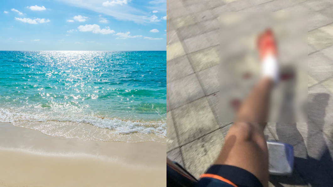 海邊戲水藏危機！男大生突遭扎腳狂噴血…網驚：小心截肢