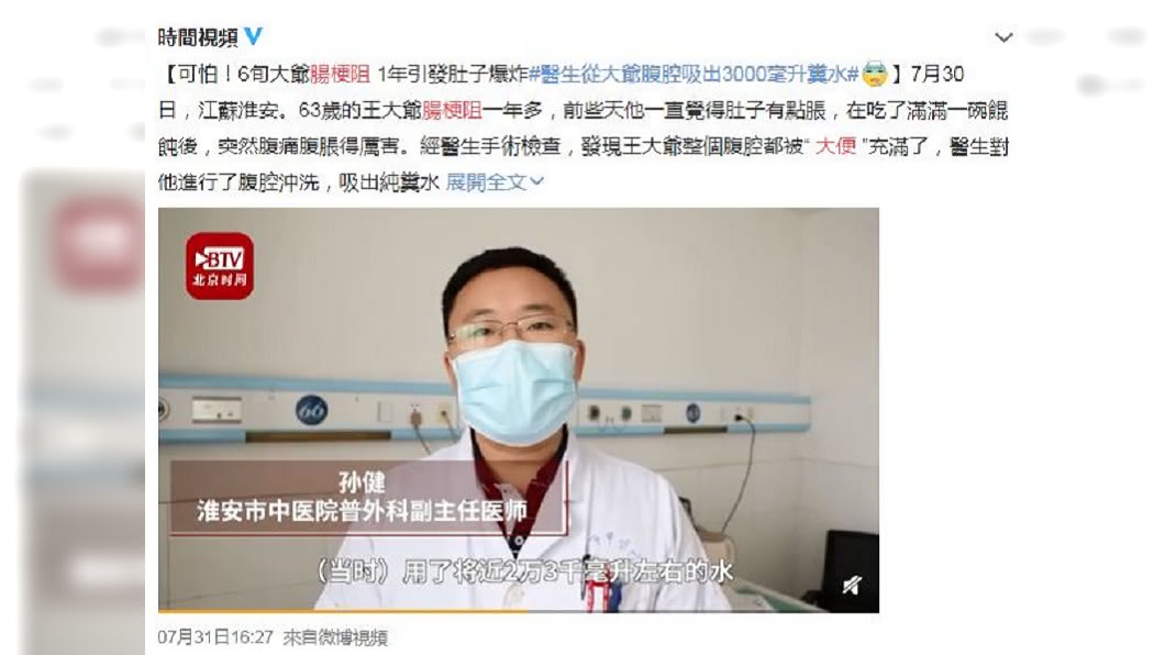 醫師從男子腹腔內抽出3000毫升的糞水。(圖/翻攝自時間視頻微博)
